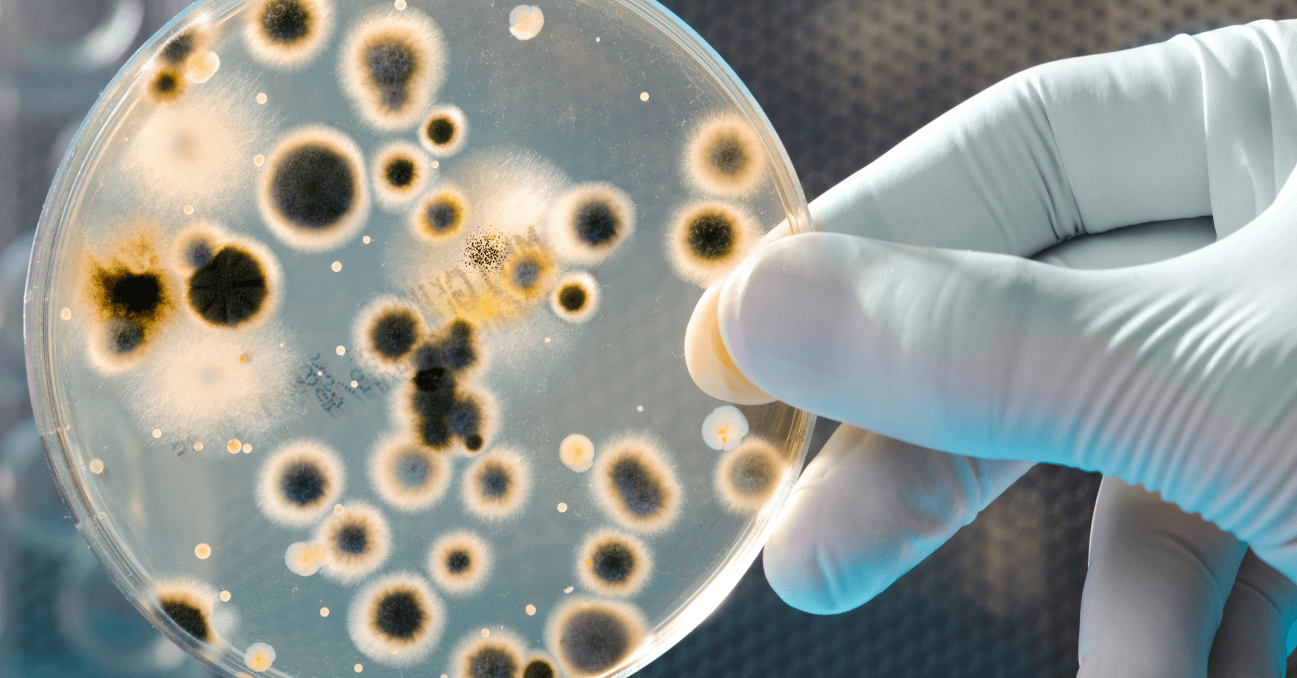 petri dish bacteria growth